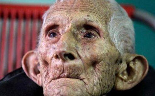 Коронавирус: в Испании стариков бросили умирать