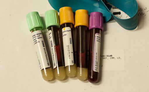 Минздрав: "Сифилис в донорской крови не обнаружен"