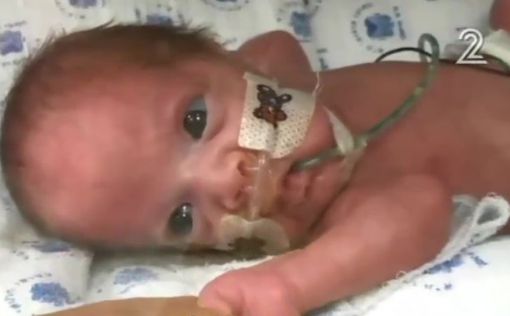 Чудо в больнице Ихилов. Рожденный на 22 неделе ребенок выжил