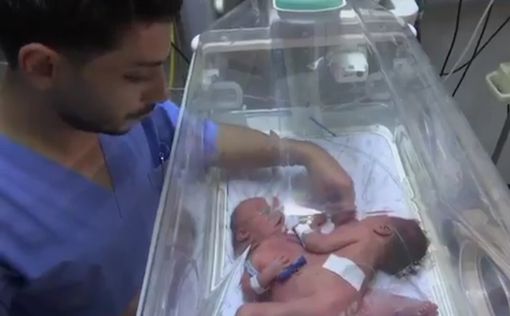 В Газе родились сиамские близнецы