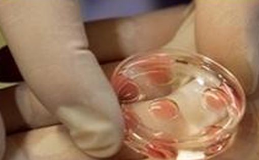 В больнице "Барзилай" пациентке ввели чужие эмбрионы