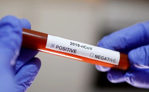 В Беларуси зафиксирован первый случай коронавируса