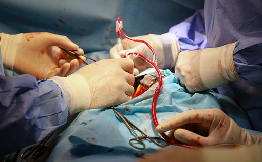 В Италии впервые в мире установили протез клапана в бьющемся сердце