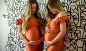 "Совместная беременность" легендарных израильских близнецов | Фото 6