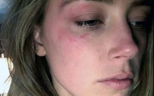 Экс-супруга Джонни Деппа: он разбил iPhone об мое лицо