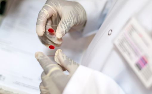 Во Франции разработали эффективные таблетки от СПИДа