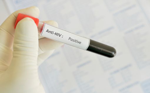 Ученые установили, где человек заразился СПИДом