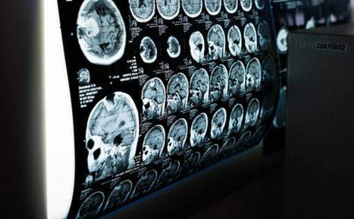 Сканирование мозга и ИИ помогли “прочесть” мысли людей – исследование