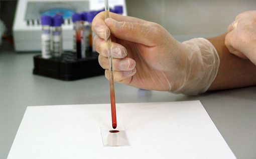 Ученые смогут предсказать смерть по анализу крови