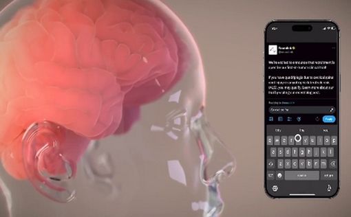 Пациент с вживленным чипом Neuralink управляет компьютером силой мысли