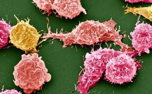 ВОЗ: К 2050 году число заболевших раком увеличится до 35 млн