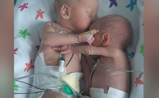 Новорожденные близнецы обнялись после вынужденной разлуки | Фото: AFP