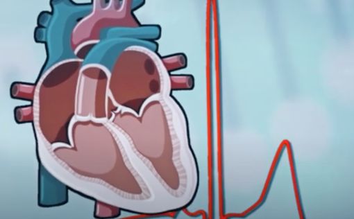 Ученые рассказали о неожиданных признаках инфаркта
