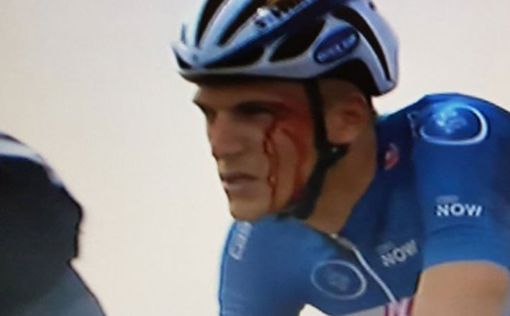 Украинский велогонщик разбил лицо лидеру "Тур Дубая"