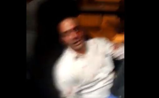 В Модиин-Илит атакован водитель-араб