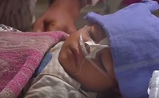 В Индии врачи перепутали беременность с опухолью