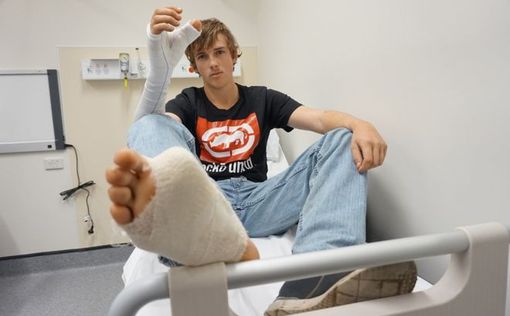 Австралийцу пересадили палец с ноги на руку